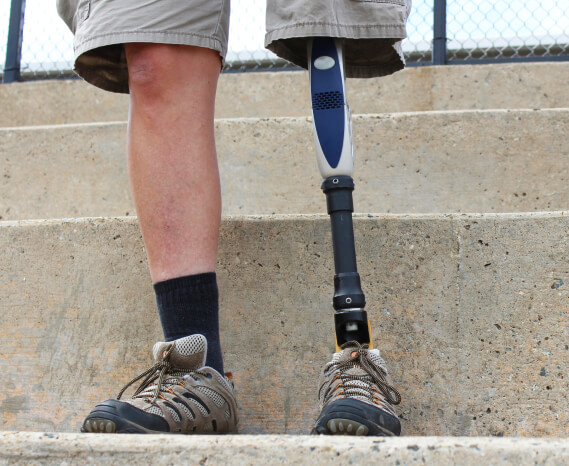 What Injuries, Illnesses and Medical Conditions Qualify for VA Compensation?