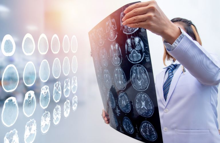 Doctor Looking at a Printout of Brain Scans