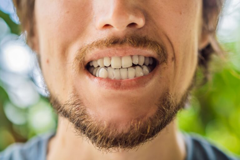 bruxism va disability