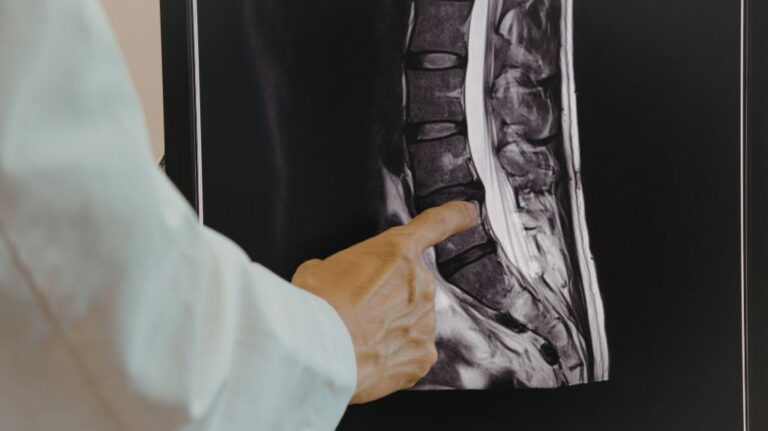 Doctor Pointing to X-Ray of a Spine