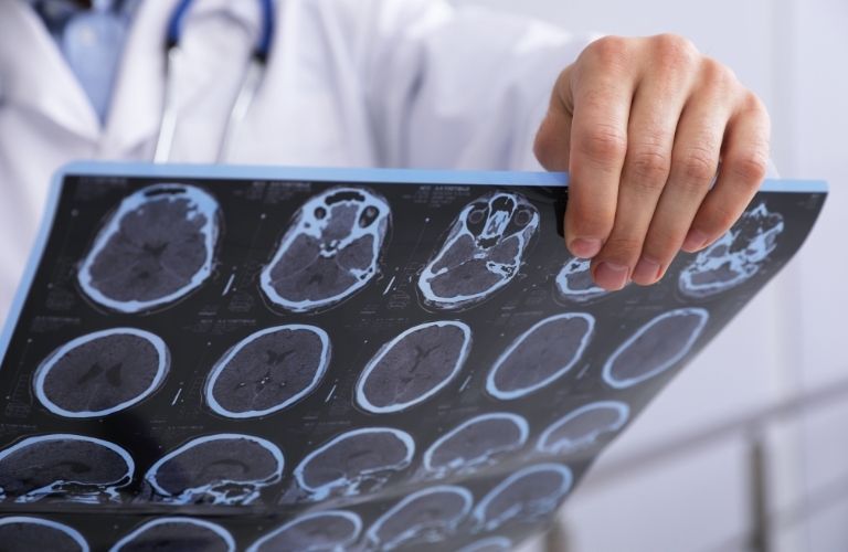 Doctor Holding Sheet with Brain Scans